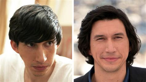 adam driver plastic surgery.